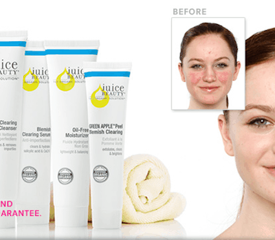 Blemish Clearing Solutions Kit Only $19.95 + Plus FREE Shipping!
